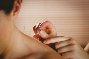 Incroyable pouvoir de l&rsquo;acuponcture pour améliorer la santé au quotidien ?
